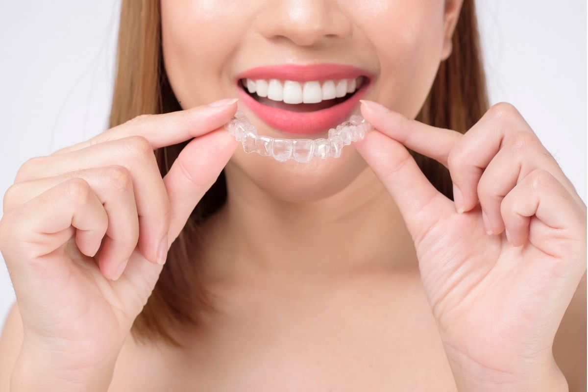 Invisalign Houston
