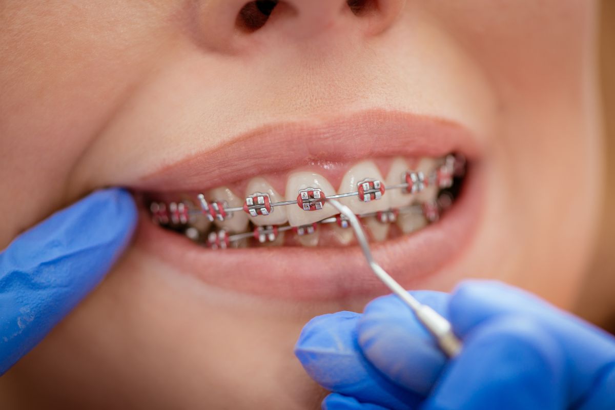 Orthodontist Houston